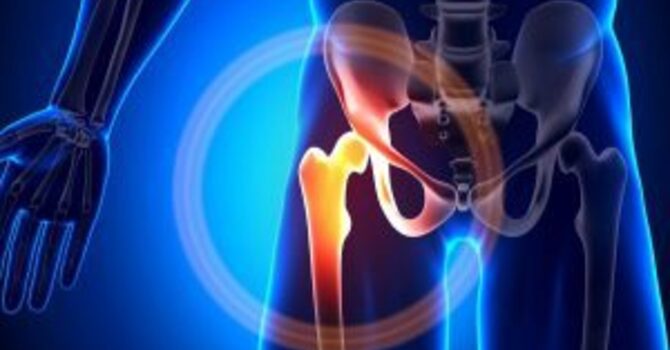 Hip Pain