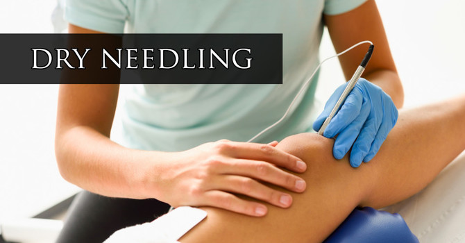 Why Dry Needling Might Be the Key to Finally Releasing Your Chronic Muscle Tightness