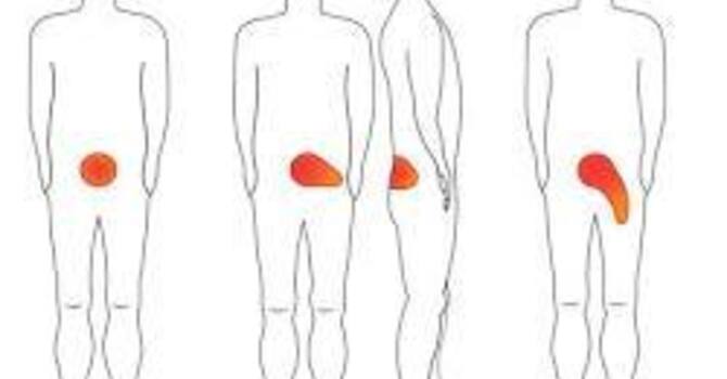 Centralization and Peripheralization: Why the Direction Your Symptoms Move Can Matter