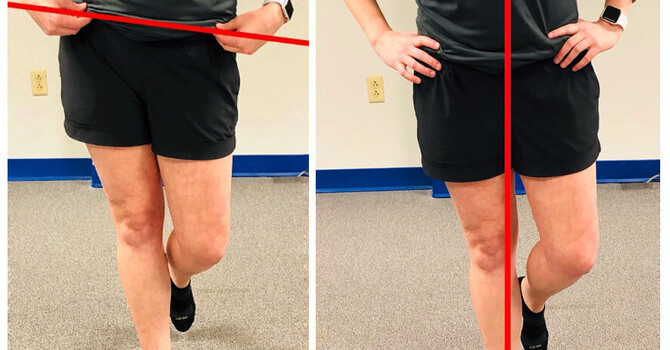A Movement Assessment for Back Pain: What Are We Actually Looking For?