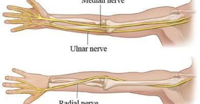 Median, Ulnar and Radial Nerves: Why Your Symptoms May Follow Different Paths
