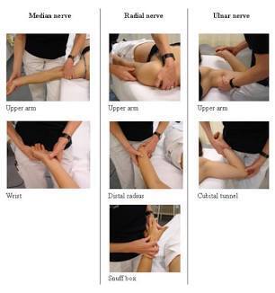 Clinician demonstrating a controlled nerve mobility exercise for the upper extremity.